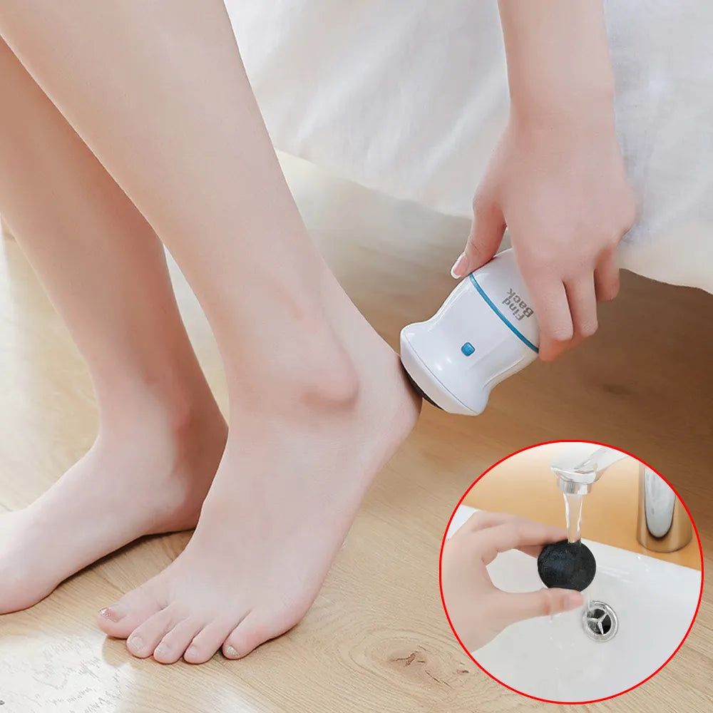 Ankle Dead Cells Remover